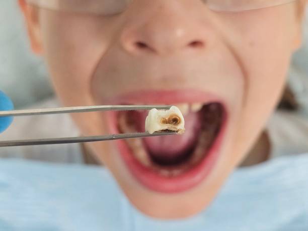 Best Cracked Tooth Emergency Dentist  in Selma, NC